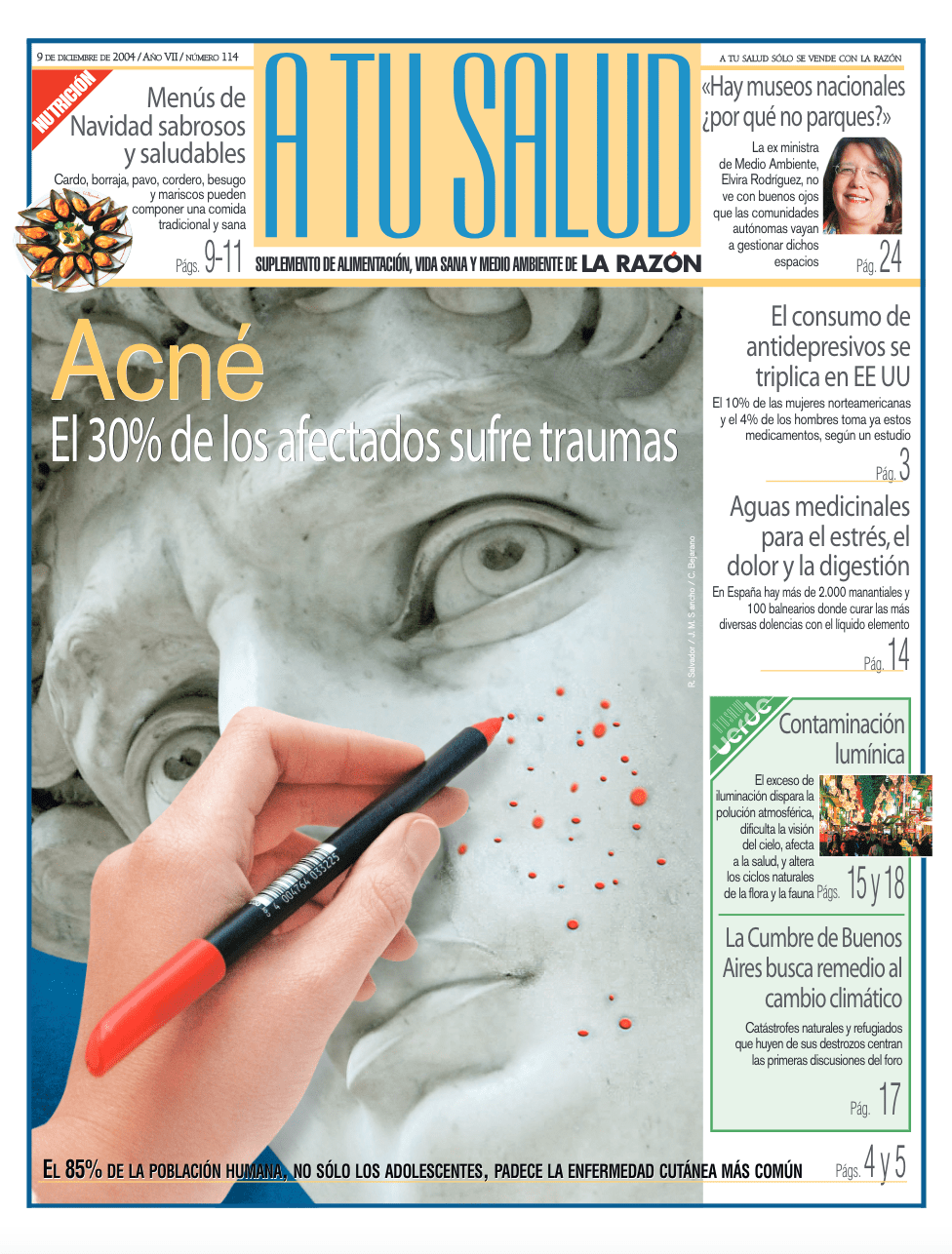 2004: acné y sus consecuencias